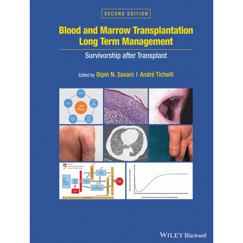 Blood and Marrow Transplantation Long Term Management: Survivorship after Transplant 2E