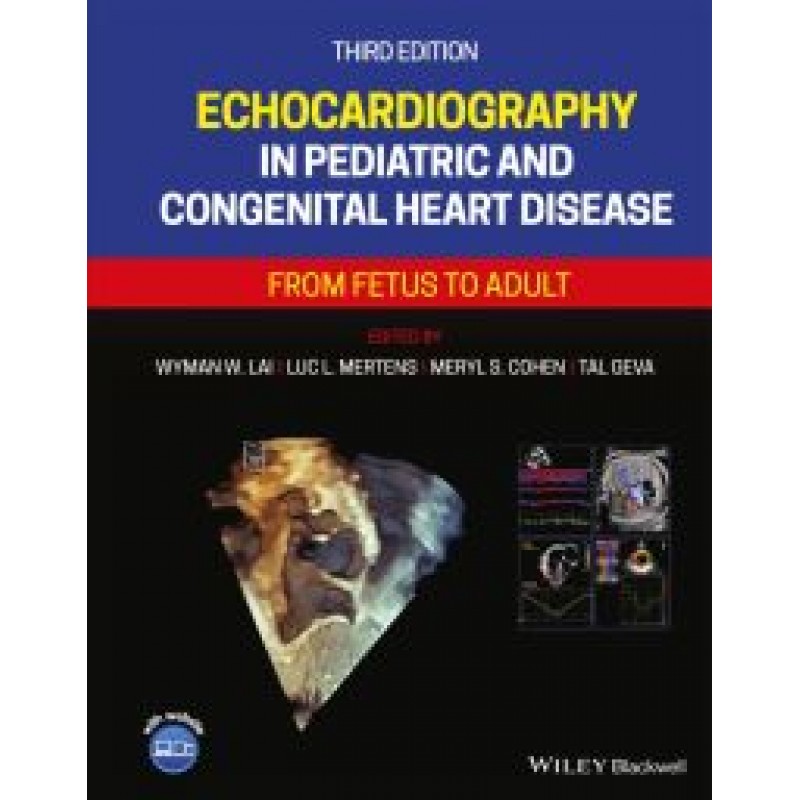 Echocardiography in Pediatric and Congenital Heart Disease: From Fetus to Adult, 3E