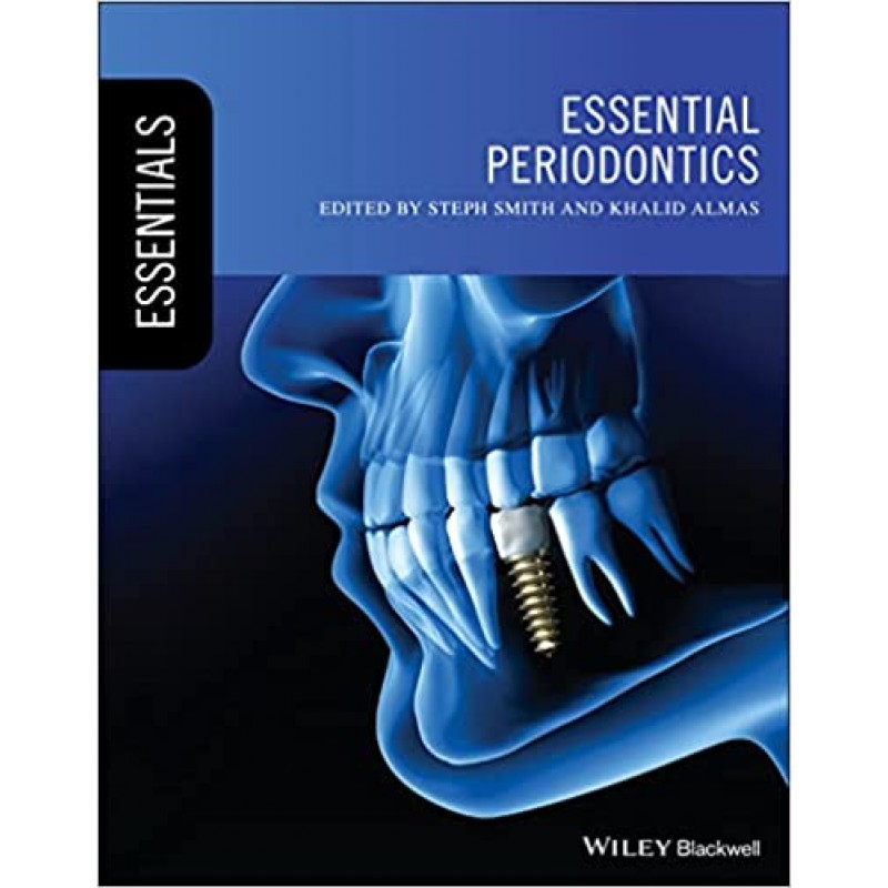 Essential Periodontics