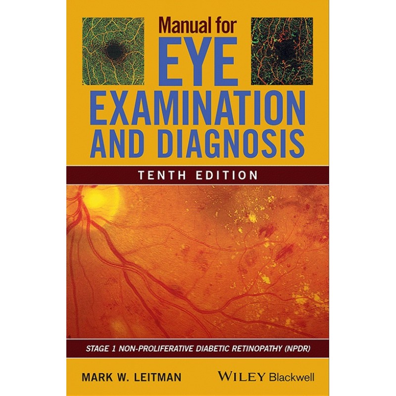 Manual for Eye Examination and Diagnosis 10E