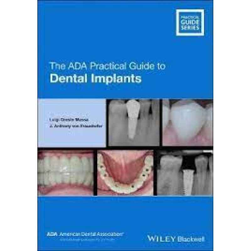 The ADA Practical Guide to Dental Implants