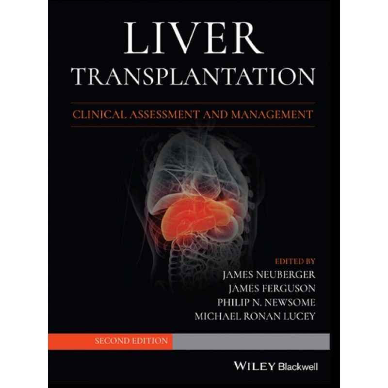 Liver Transplantation: Clinical Assessment and Management 2E