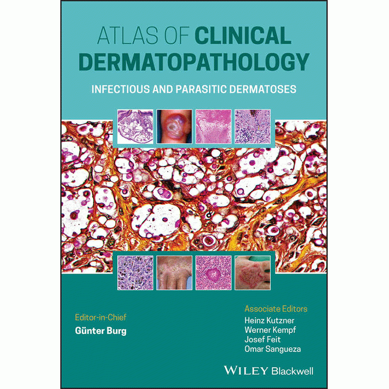 Atlas of Clinical Dermatopathology: Infectious and Parasitic Dermatoses