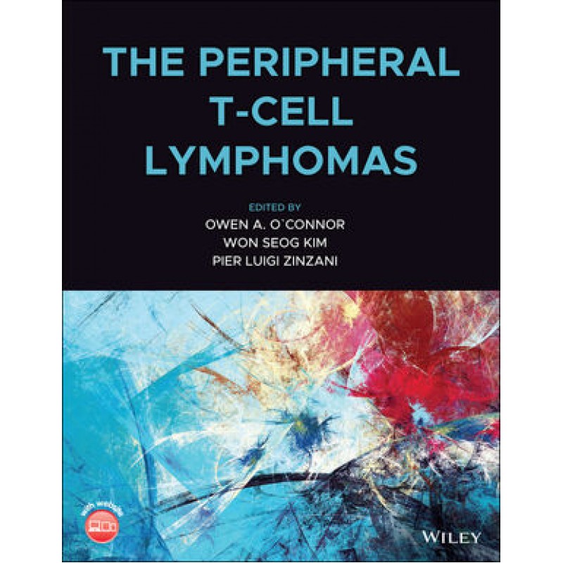 The Peripheral T-Cell Lymphomas