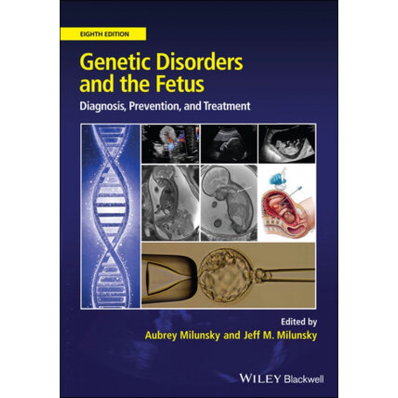 Genetic Disorders and the Fetus: Diagnosis, Prevention and Treatment 8E