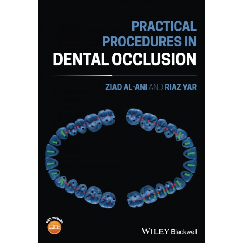 Practical Procedures in Dental Occlusion