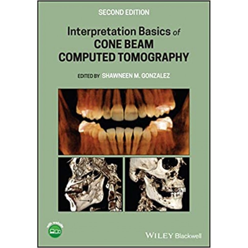 Interpretation Basics of Cone Beam Computed Tomography, 2E