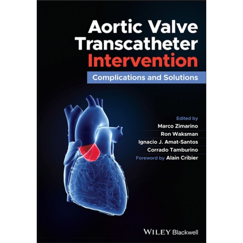 Aortic Valve Transcatheter Intervention: Complications and Solutions