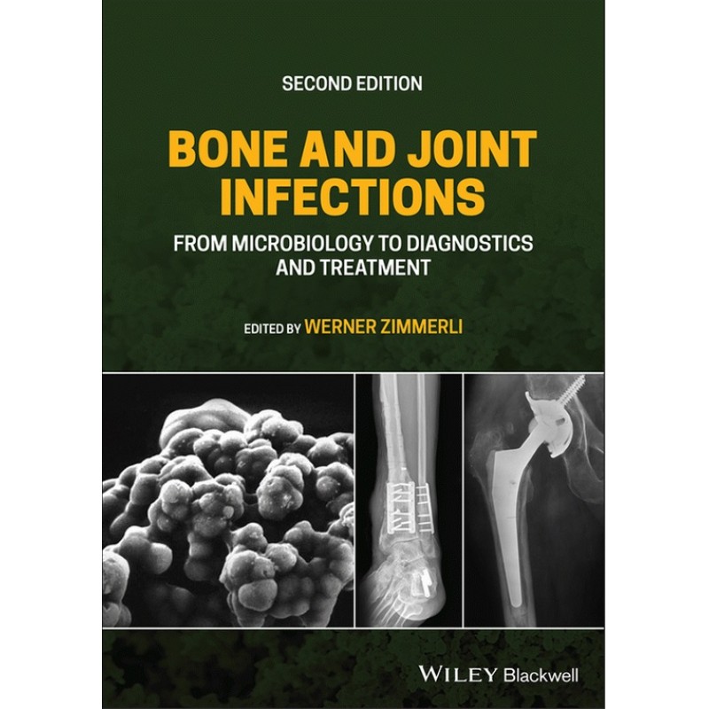 Bone and Joint Infections: From Microbiology to Diagnostics and Treatment 2E