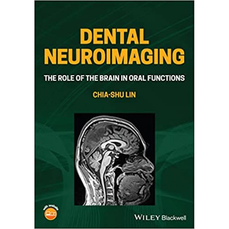 Dental Neuroimaging: The Role of the Brain in Oral Functions