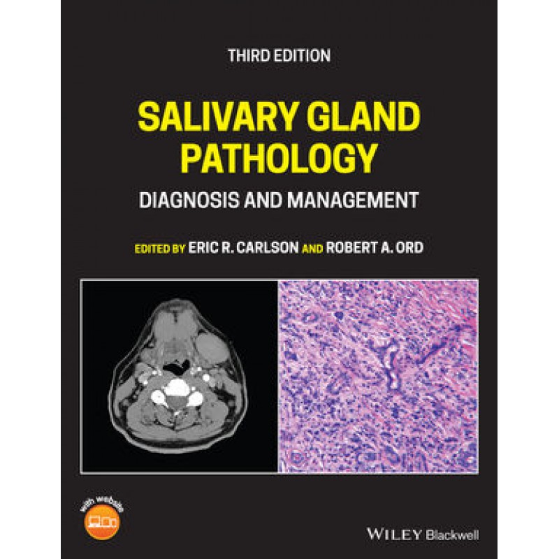 Salivary Gland Pathology: Diagnosis and Management 3E 