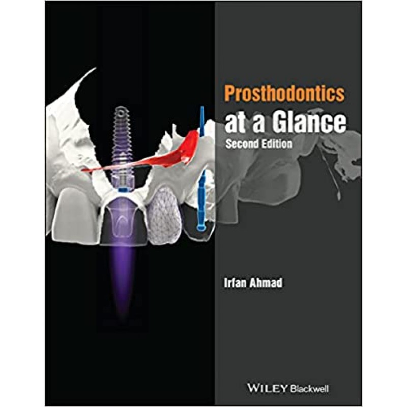 Prosthodontics at a Glance, 2E