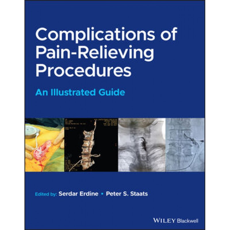 Complications of Pain-Relieving Procedures: An Illustrated Guide