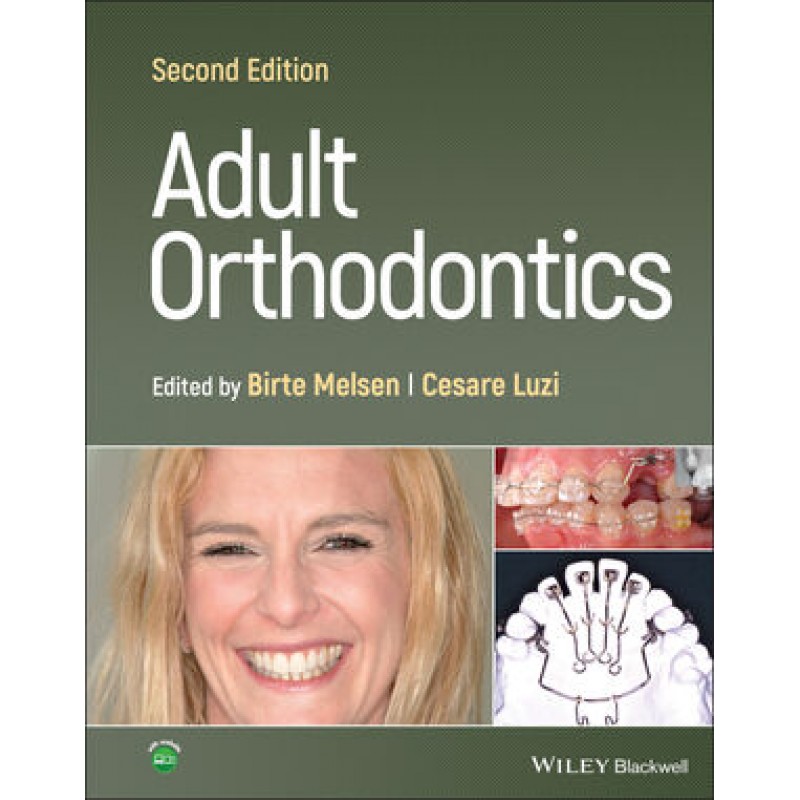 Adult Orthodontics, 2E