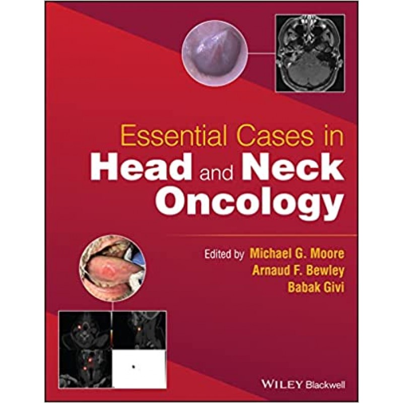 Essential Cases in Head and Neck Oncology