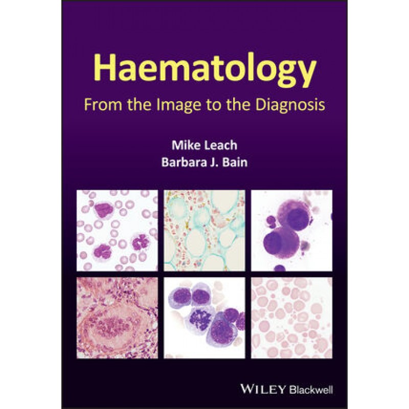 Haematology: From the Image to the Diagnosis 