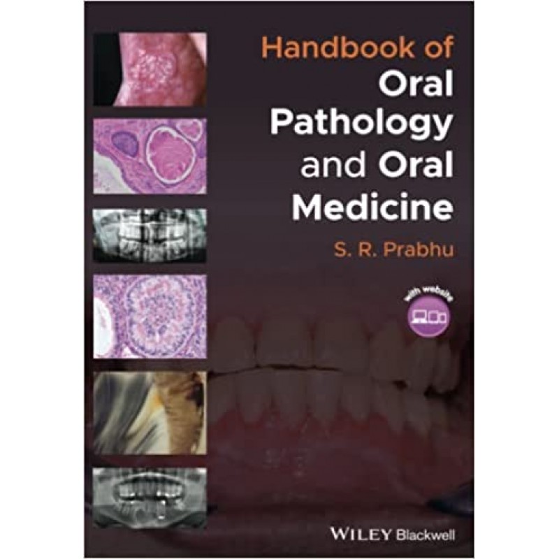 Handbook of Oral Pathology and Oral Medicine