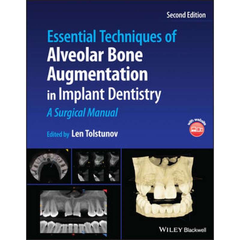 Essential Techniques of Alveolar Bone Augmentation in Implant Dentistry: A Surgical Manual, 2E