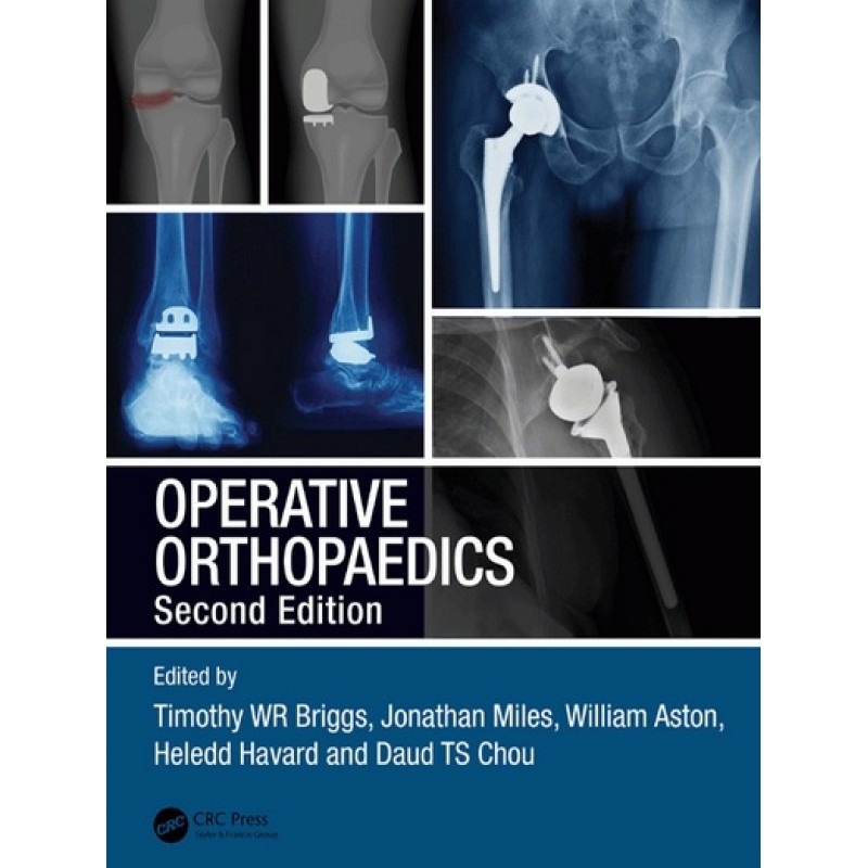 Operative Orthopaedics 2E