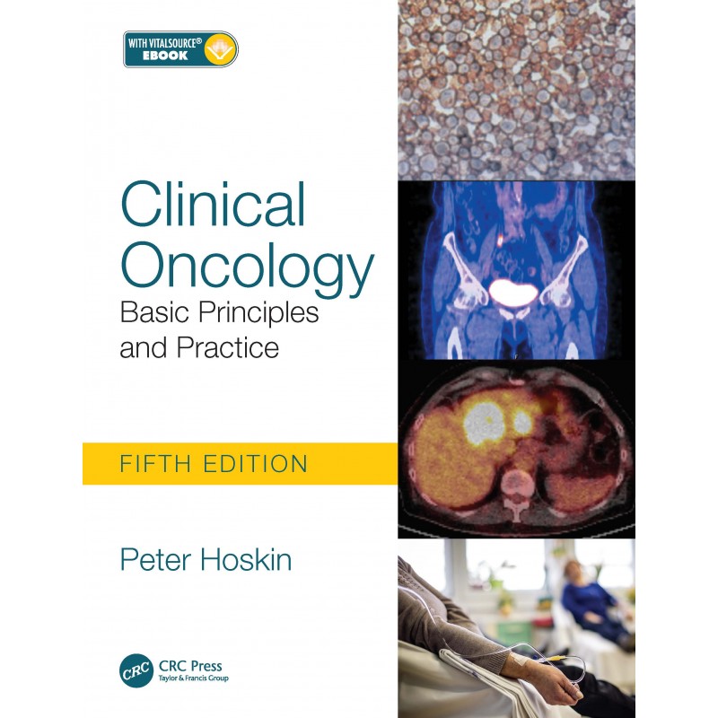 Clinical Oncology Basic Principles and Practice 5th Edition