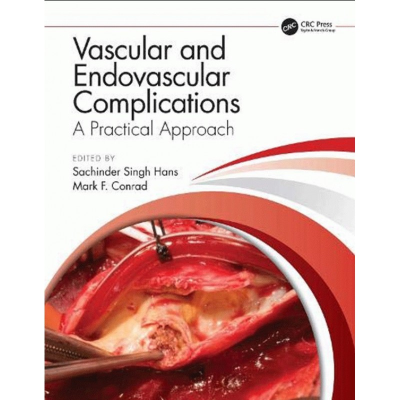 Vascular and Endovascular Complications: A Practical Approach 