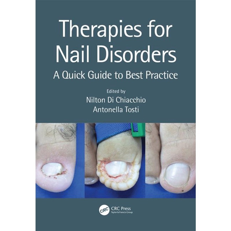 Therapies for Nail Disorders A Quick Guide to Best Practice