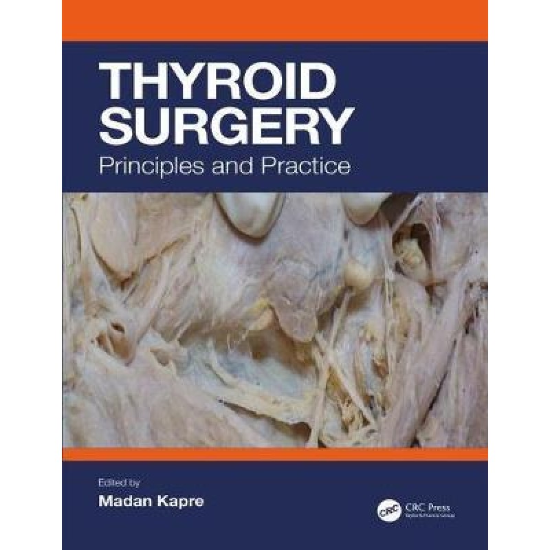 Thyroid Surgery - Principles and Practice