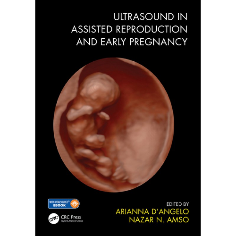 Ultrasound in Assisted Reproduction and Early Pregnancy 1E