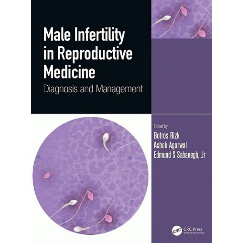 Male Infertility in Reproductive Medicine Diagnosis and Management