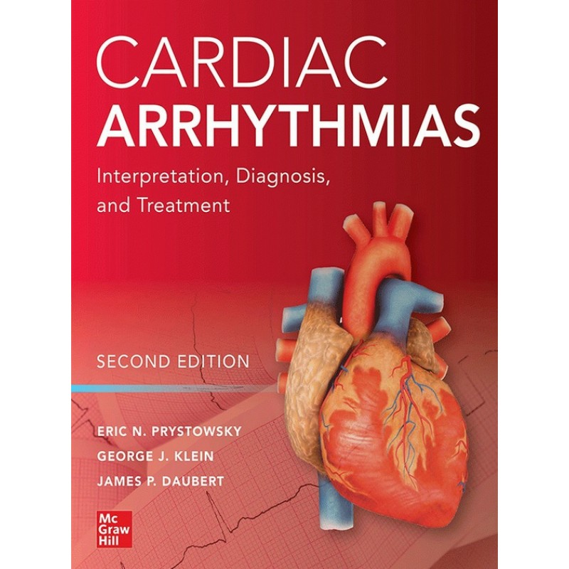 Cardiac Arrhythmias: Interpretation, Diagnosis and Treatment 2E