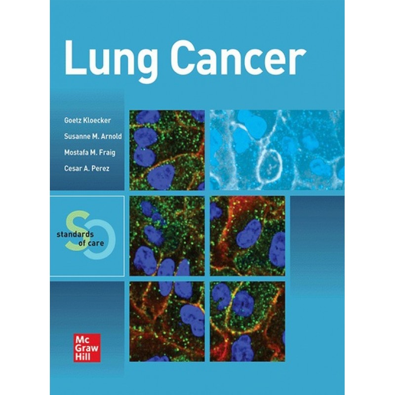 Lung Cancer: Standards of Care