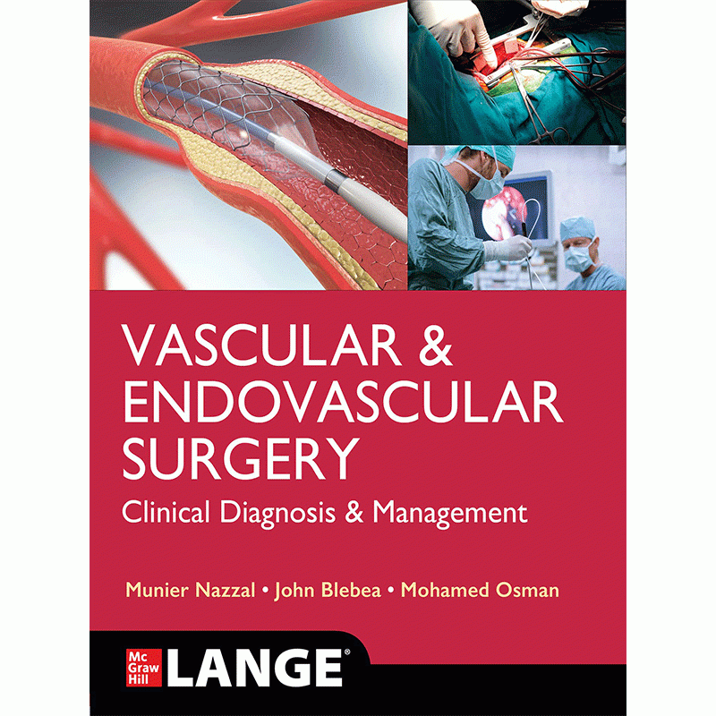 Vascular and Endovascular Surgery: Clinical Diagnosis and Management