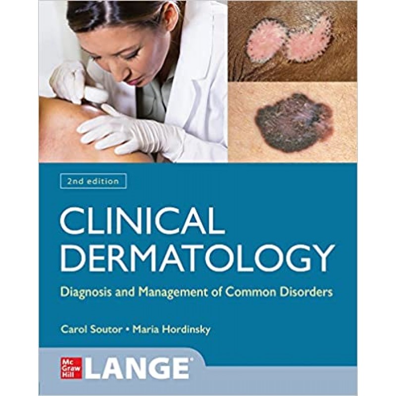 Clinical Dermatology: Diagnosis and Management of Common Disorders, 2E