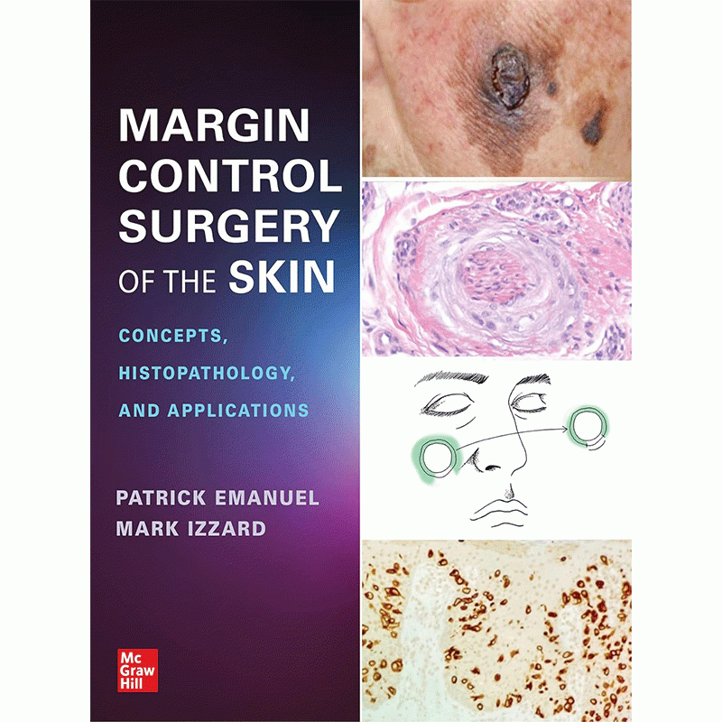 Margin Control Surgery of the Skin: Concepts, Histopathology, and Applications