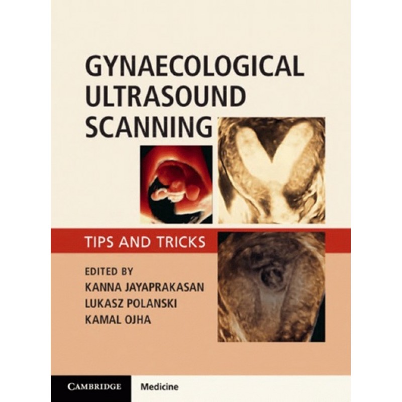 Gynaecological Ultrasound Scanning Tips and Tricks