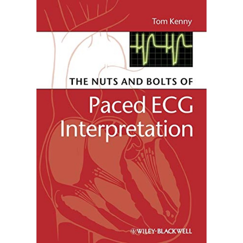 The Nuts and bolts of Paced ECG Interpretation