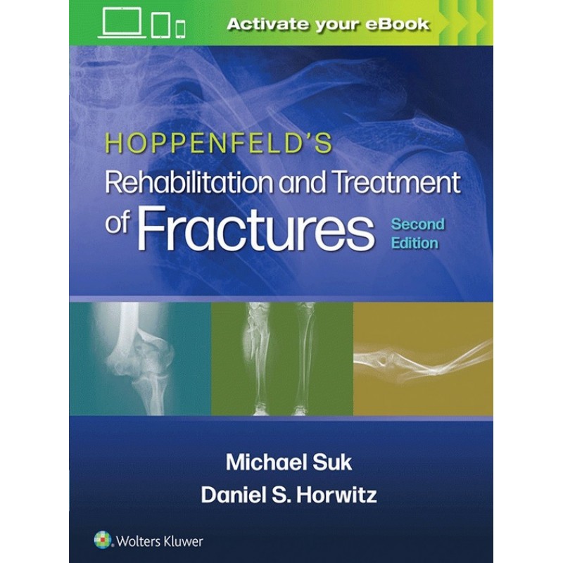 Hoppenfeld's Rehabilitation and Treatment of Fractures, 2E