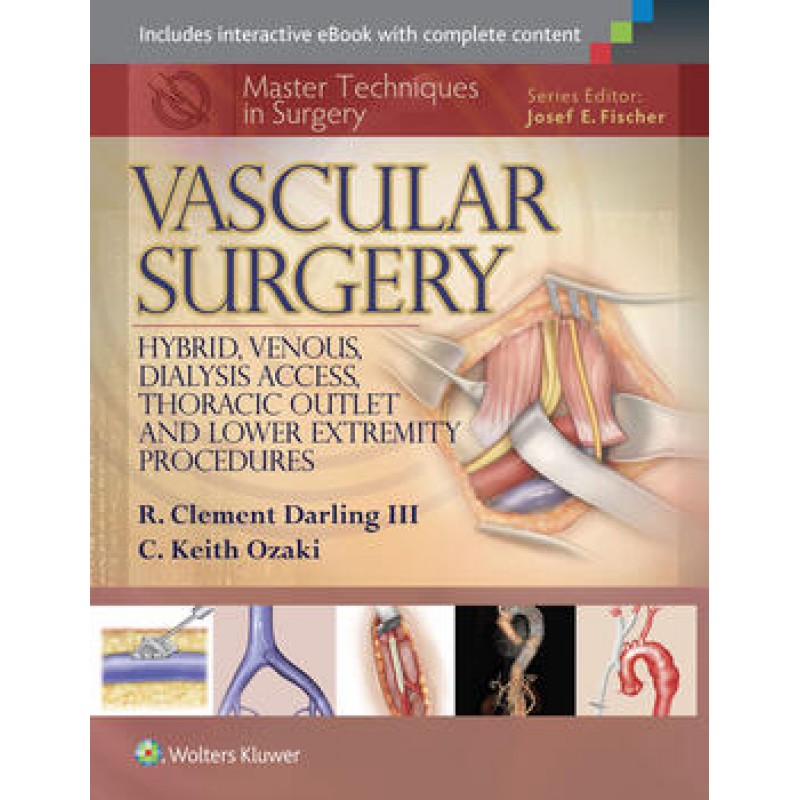 Master Techniques in Surgery: Vascular Surgery: Hybrid, Venous, Dialysis Access, Thoracic Outlet, and Lower Extremity Procedures