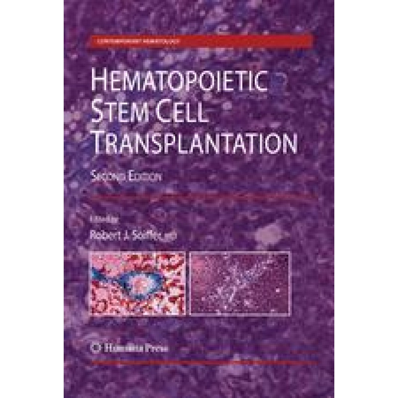 Hematopoietic Stem Cell Transplantation 