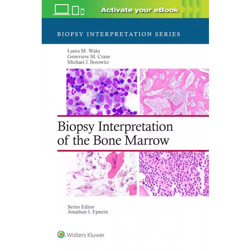 Biopsy Interpretation of the Bone Marrow, 1st Εdition, Biopsy Interpretation Series