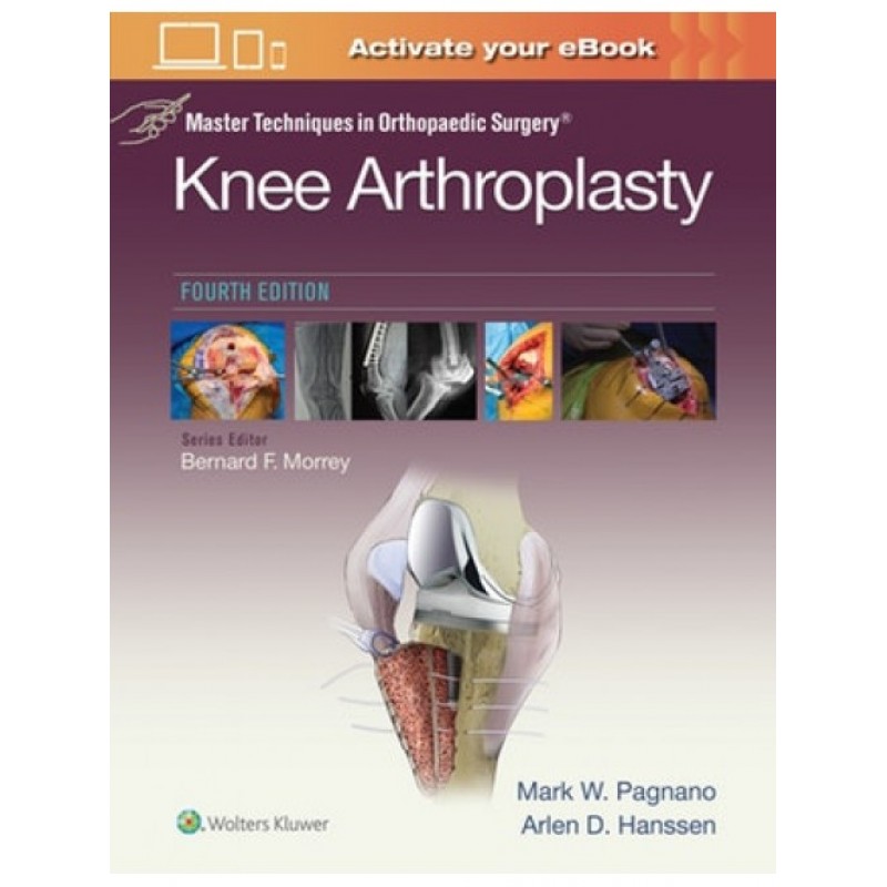 Master Techniques in Orthopedic Surgery: Knee Arthroplasty 4E