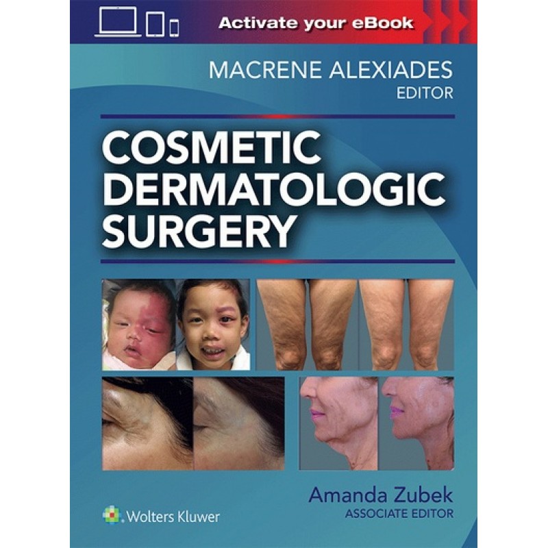 Cosmetic Dermatologic Surgery