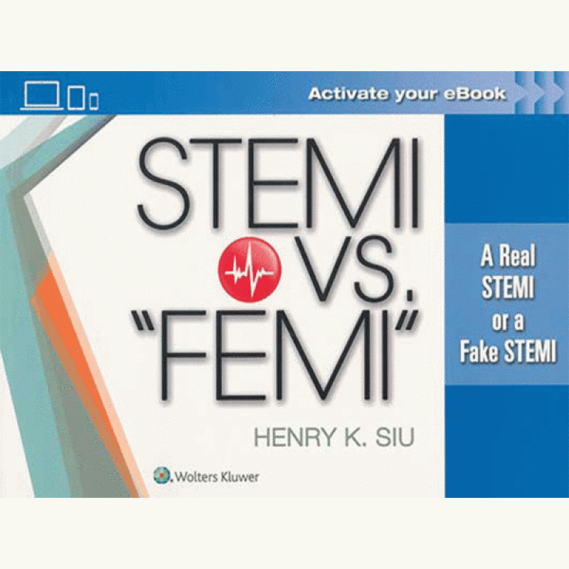 STEMI vs. “FEMI”: A Real STEMI or a Fake STEMI