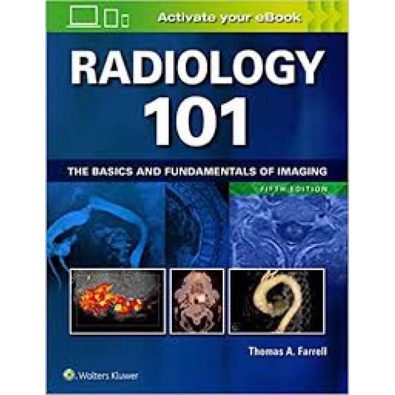 Radiology 101 The Basics and Fundamentals of Imaging, 5E