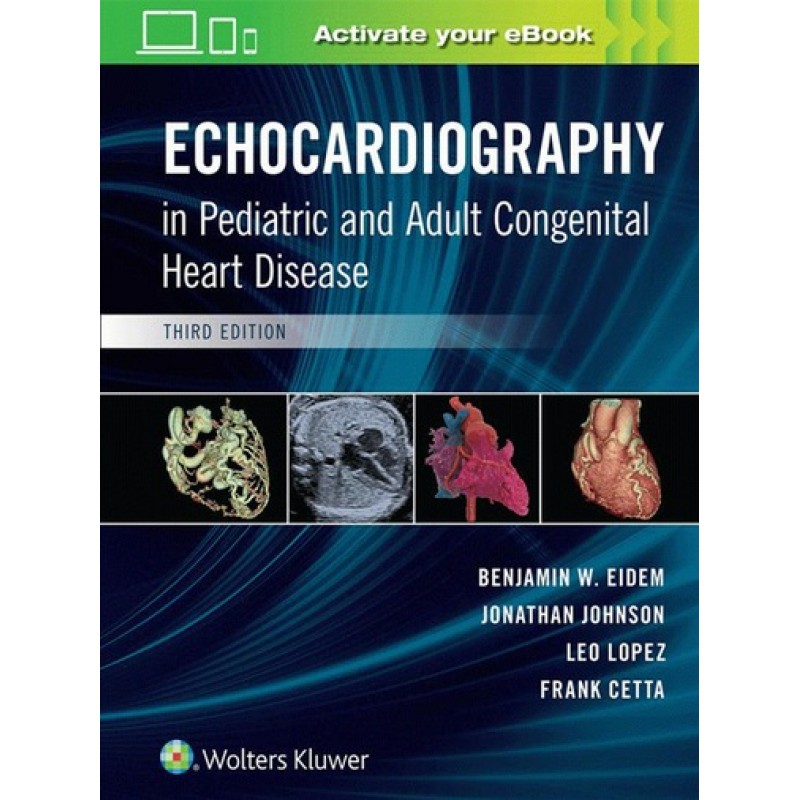 Echocardiography in Pediatric and Adult Congenital Heart Disease 3E