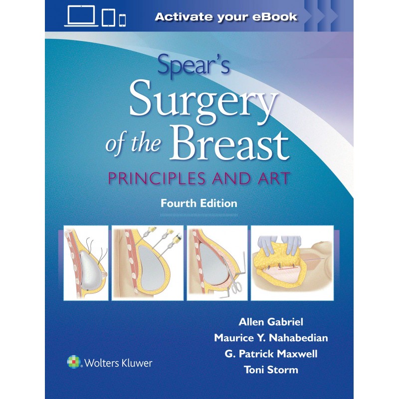 Spear's Surgery of the Breast - Principles and Art, 4th edition