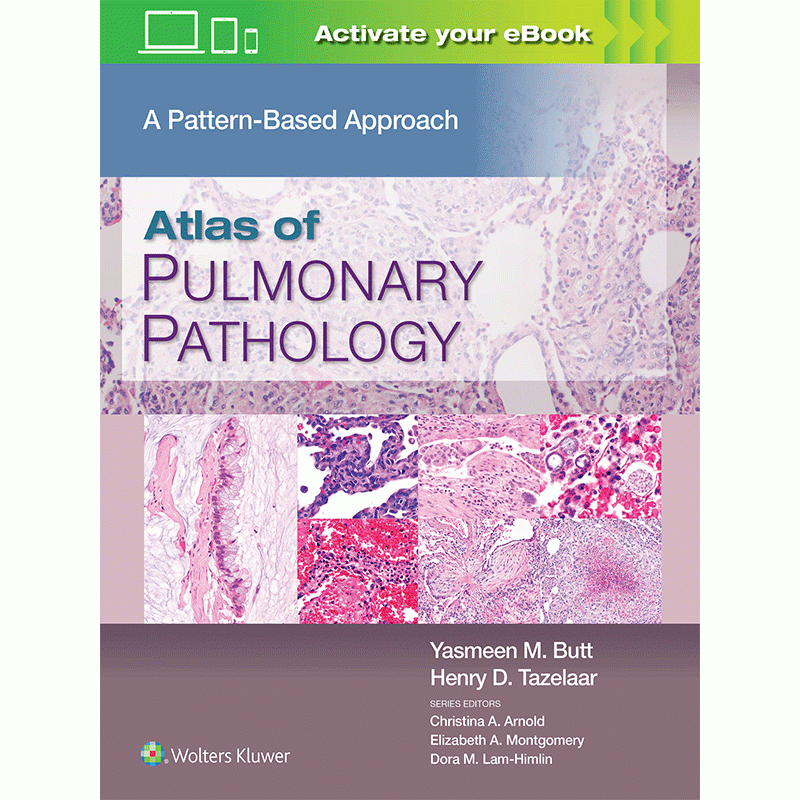 Atlas of Pulmonary Pathology: A Pattern Based Approach