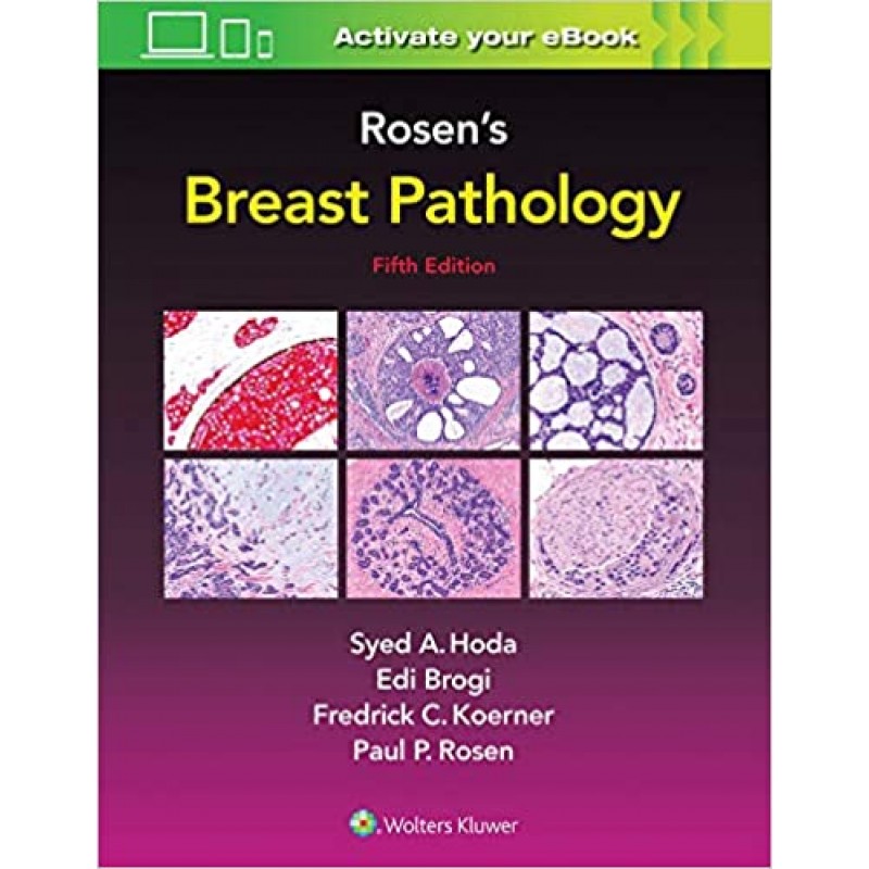 Rosen's Breast Pathology 5th edition