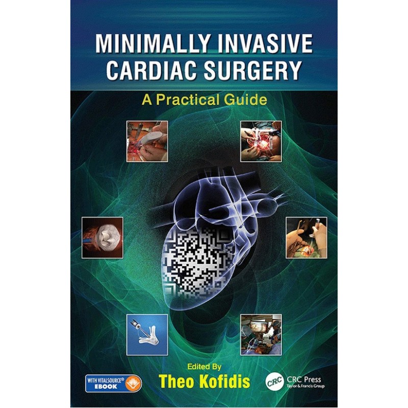 Minimally Invasive Cardiac Surgery: A Practical Guide