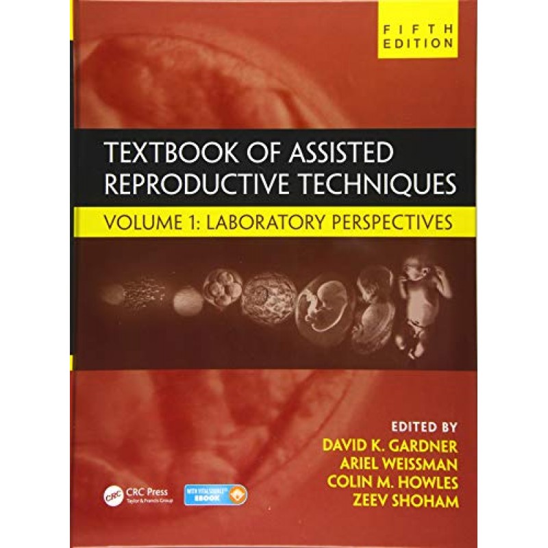 Textbook of Assisted Reproductive Techniques 2 VOLUME SET